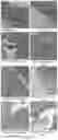Fig. 04 - NEW USE OF BIFIDOBACTERIUM LACTIS BL-99 IN SUPPRESSION OF INTESTINAL INFLAMMATION