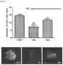 Fig. 02 - COMPOSITION COMPRISING SWEET POTATO STEM OR LEAF EXTRACT AS ACTIVE INGREDIENT FOR PREVENTION OR TREATMENT OF EAR DISEASE