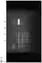 Fig. 04 - MESENCHYMAL STEM CELL EXPRESSING HEPATOCYTE GROWTH FACTOR, AND USE THEREOF