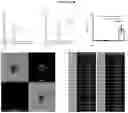 Fig. 05 - METHODS OF TREATMENT RELATED TO COMPLEXES OF VON WILLEBRAND FACTOR AND COMPLEMENT C1Q