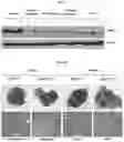 Fig. 03 - Pharmaceutical composition for diagnosing, preventing or treating liver cancer using SSU72 protein or a polynucleotide encoding the same