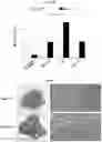 Fig. 05 - Pharmaceutical composition for diagnosing, preventing or treating liver cancer using SSU72 protein or a polynucleotide encoding the same