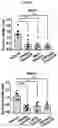 Fig. 10 - Pharmaceutical composition for diagnosing, preventing or treating liver cancer using SSU72 protein or a polynucleotide encoding the same