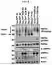 Fig. 11 - Pharmaceutical composition for diagnosing, preventing or treating liver cancer using SSU72 protein or a polynucleotide encoding the same