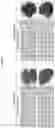 Fig. 15 - Pharmaceutical composition for diagnosing, preventing or treating liver cancer using SSU72 protein or a polynucleotide encoding the same