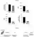 Fig. 16 - Pharmaceutical composition for diagnosing, preventing or treating liver cancer using SSU72 protein or a polynucleotide encoding the same