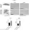 Fig. 17 - Pharmaceutical composition for diagnosing, preventing or treating liver cancer using SSU72 protein or a polynucleotide encoding the same