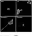 Fig. 18 - Hyperactive Dendritic Cells Enable Durable Adoptive Cell Transfer-Based Anti-Tumor Immunity