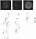 Fig. 32 - CHIMERIC RECEPTOR PROTEINS AND USES THEREOF