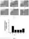 Fig. 14 - COMPOSITION AND METHOD FOR TREATMENT OF MULTIPLE SCLEROSIS