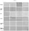 Fig. 11 - CARDIOPROTECTIVE MICROBUBBLE-LIPOSOMAL DRUG COMPLEXES