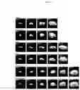 Fig. 18 - CARDIOPROTECTIVE MICROBUBBLE-LIPOSOMAL DRUG COMPLEXES