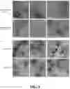 Fig. 14 - COMPOSITIONALLY DEFINED PLASMID DNA/POLYCATION NANOPARTICLES AND METHODS FOR MAKING THE SAME