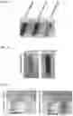 Fig. 04 - GOLD NANOPARTICLES/NANOSHELLS IMMUNE CONJUGATES FOR ENHANCED IMMUNOTHERAPY AND PHOTOTHERMAL THERAPY FOR HEMATOLOGIC MALIGNANCIES