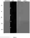 Fig. 88 - Upconversion nanoparticle peptide conjugates