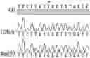 Fig. 01 - OPTIDICER CONSTRUCT FOR AGE-RELATED MACULAR DEGENERATION