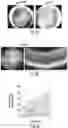 Fig. 03 - OPTIDICER CONSTRUCT FOR AGE-RELATED MACULAR DEGENERATION