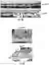 Fig. 04 - OPTIDICER CONSTRUCT FOR AGE-RELATED MACULAR DEGENERATION