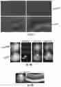 Fig. 05 - OPTIDICER CONSTRUCT FOR AGE-RELATED MACULAR DEGENERATION