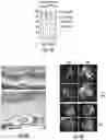 Fig. 06 - OPTIDICER CONSTRUCT FOR AGE-RELATED MACULAR DEGENERATION