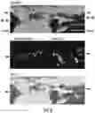 Fig. 08 - OPTIDICER CONSTRUCT FOR AGE-RELATED MACULAR DEGENERATION