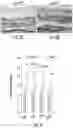 Fig. 11 - OPTIDICER CONSTRUCT FOR AGE-RELATED MACULAR DEGENERATION