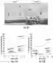 Fig. 12 - OPTIDICER CONSTRUCT FOR AGE-RELATED MACULAR DEGENERATION