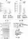 Fig. 14 - OPTIDICER CONSTRUCT FOR AGE-RELATED MACULAR DEGENERATION