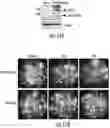 Fig. 16 - OPTIDICER CONSTRUCT FOR AGE-RELATED MACULAR DEGENERATION