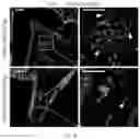 Fig. 19 - USE OF SUMF2 GENE AS A GENE THERAPY TARGET FOR PREVENTING AND/OR TREATING ALLERGIC ASTHMA ATTACK AND REDUCING AIRWAY HYPERRESPONSIVENESS