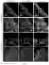 Fig. 22 - USE OF SUMF2 GENE AS A GENE THERAPY TARGET FOR PREVENTING AND/OR TREATING ALLERGIC ASTHMA ATTACK AND REDUCING AIRWAY HYPERRESPONSIVENESS