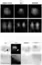 Fig. 05 - A UROKINASE PLASMINOGEN ACTIVATOR RECEPTOR-TARGETING PEPTIDE
