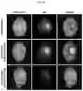 Fig. 11 - A UROKINASE PLASMINOGEN ACTIVATOR RECEPTOR-TARGETING PEPTIDE
