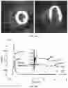 Fig. 04 - SYSTEM AND METHOD FOR QUANTITATIVE MAPPING OF MITOCHONDRIAL COMPLEX 1
