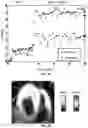 Fig. 06 - SYSTEM AND METHOD FOR QUANTITATIVE MAPPING OF MITOCHONDRIAL COMPLEX 1