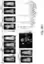 Fig. 15 - LOW MOLECULAR WEIGHT AND POLYAMIDOAMINE (PAMAM) DENDRIMER BASED PSMA-SPECIFIC DUAL CONTRAST AGENTS FOR OPTICAL AND PHOTOACOUSTIC IMAGING AND THERANOSTIC AGENTS FOR TREATING PROSTATE CANCER