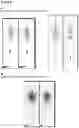 Fig. 07 - RADIOIMMUNOCONJUGATE FOR USE IN TREATING BONE MARROW ASSOCIATED DISEASES