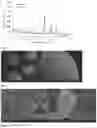 Fig. 03 - Composition of substantially spherical granule for bone regeneration