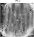 Fig. 17 - 3D VASCULARIZED HUMAN OCULAR TISSUE FOR CELL THERAPY AND DRUG DISCOVERY