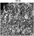 Fig. 18 - 3D VASCULARIZED HUMAN OCULAR TISSUE FOR CELL THERAPY AND DRUG DISCOVERY