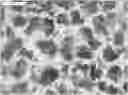 Fig. 01 - Injectable gel product