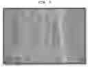 Fig. 04 - TISSUE RESTORATION COMPOSITION