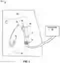 Fig. 02 - CATHETER CUFF