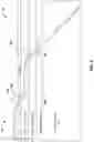 Fig. 04 - CATHETER CUFF