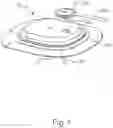 Fig. 02 - IRREMOVABLE BUCKLING-RESISTANT FLEXIBLE CANNULA AND PROCESS