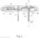 Fig. 03 - IRREMOVABLE BUCKLING-RESISTANT FLEXIBLE CANNULA AND PROCESS