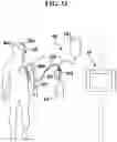 Fig. 13 - BODY FLUID MANAGEMENT SYSTEMS FOR PATIENT CARE