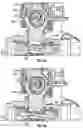 Fig. 03 - SYSTEM AND METHOD FOR DETECTING A FAULTY OCCLUDER VALVE