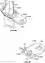 Fig. 37 - Antiseptic cap that releases a gas such as nitric oxide