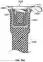 Fig. 45 - Antiseptic cap that releases a gas such as nitric oxide